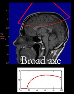 broad axe simulation